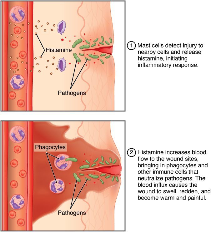 inflammation-marijuana-benefits-medical-marijuana-inc
