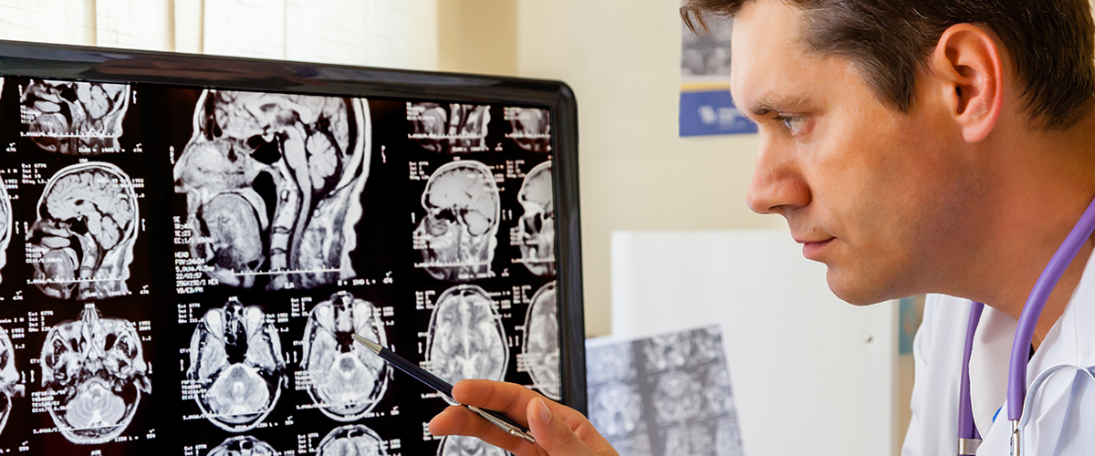 traumatic brain injury CTE concussions research