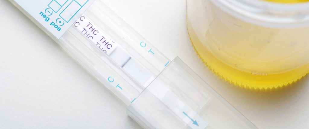medical marijuana urine test